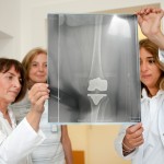 Ärztinnen schauen sich ein Röntgenbild an.